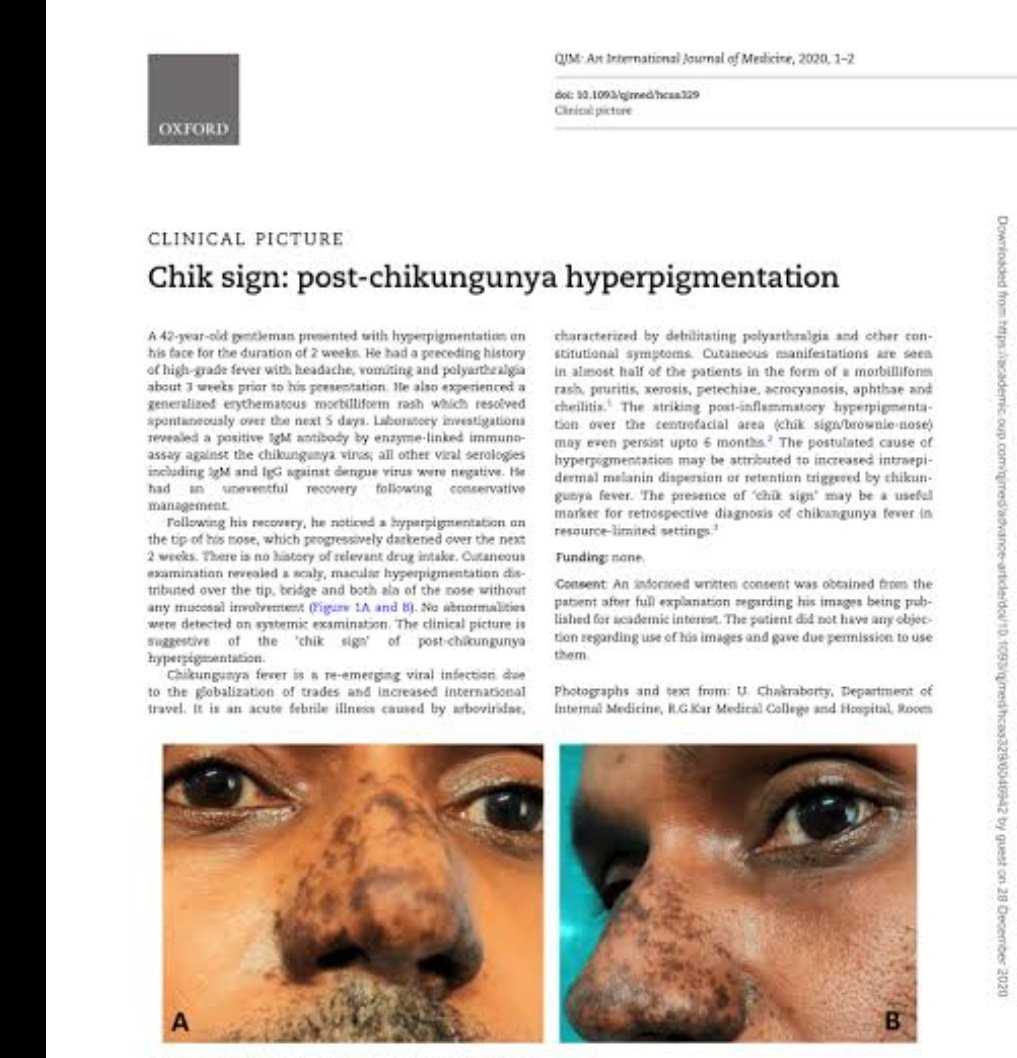 2GPcMplIhsKgqRl's tweet image. #Chikungunya #TestPCR
#dengue and #Zika