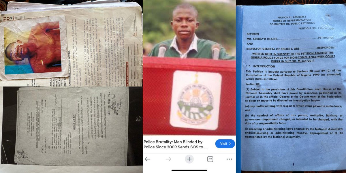 instablog9ja's tweet photo. Nigerian Police Disobey Court Ruling, Refuse To Pay N20million Compensation To Osun State Student, Olaide After Officers Brutalised, Damaged His Eyesight. https://t.co/P9Nfwmkuch