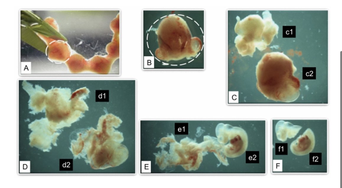 Ch_Cipriani's tweet photo. Our paper about the deregulated expression of selected #ERVs and inflammatory mediators at the maternal–fetal interface and in embryonic tissues in the idiopathic mouse model of #ASD represented by the #BTBR strain is out 🔬🙌📢 on @SciReports in collaboration with @istsupsan https://t.co/zN4B5uzH4z