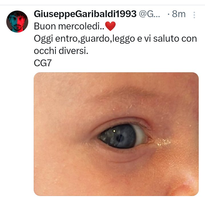 GabriellaZunin1's tweet photo. È bellissimo ogni tanto guardare il mondo con gli occhi innocenti di un bambino .
La tua nipotina ha degli occhi meravigliosi ❤️
#GiuseppeGaribaldi1993
#CG7
#solocosebelle
#beabaldi https://t.co/xoSVUNji0s