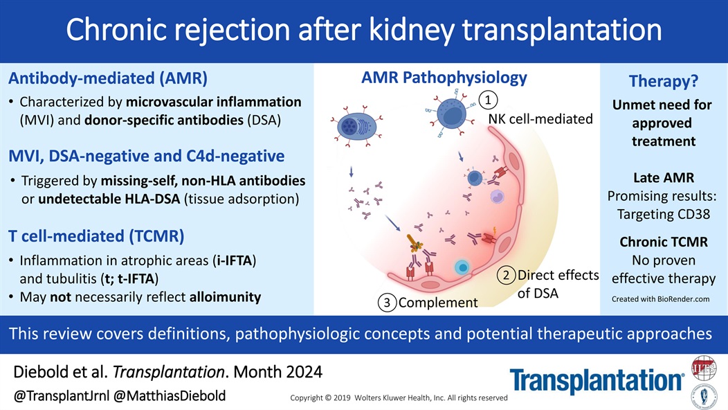 Transplantation (@transplantjrnl) on Twitter photo Chronic rejection in kidney transplants can lead to graft failure. NK cells play a key role in antibody-mediated rejection. Promising therapies like felzartamab, targeting NK cell function, show potential in addressing this challenge. <a href="/MatthiasDiebold/">Matthias Diebold</a> # tinyurl.com/2af5k5tf Chronic rejection in kidney transplants can lead to graft failure. NK cells play a key role in antibody-mediated rejection. Promising therapies like felzartamab, targeting NK cell function, show potential in addressing this challenge. <a href="/MatthiasDiebold/">Matthias Diebold</a> # tinyurl.com/2af5k5tf