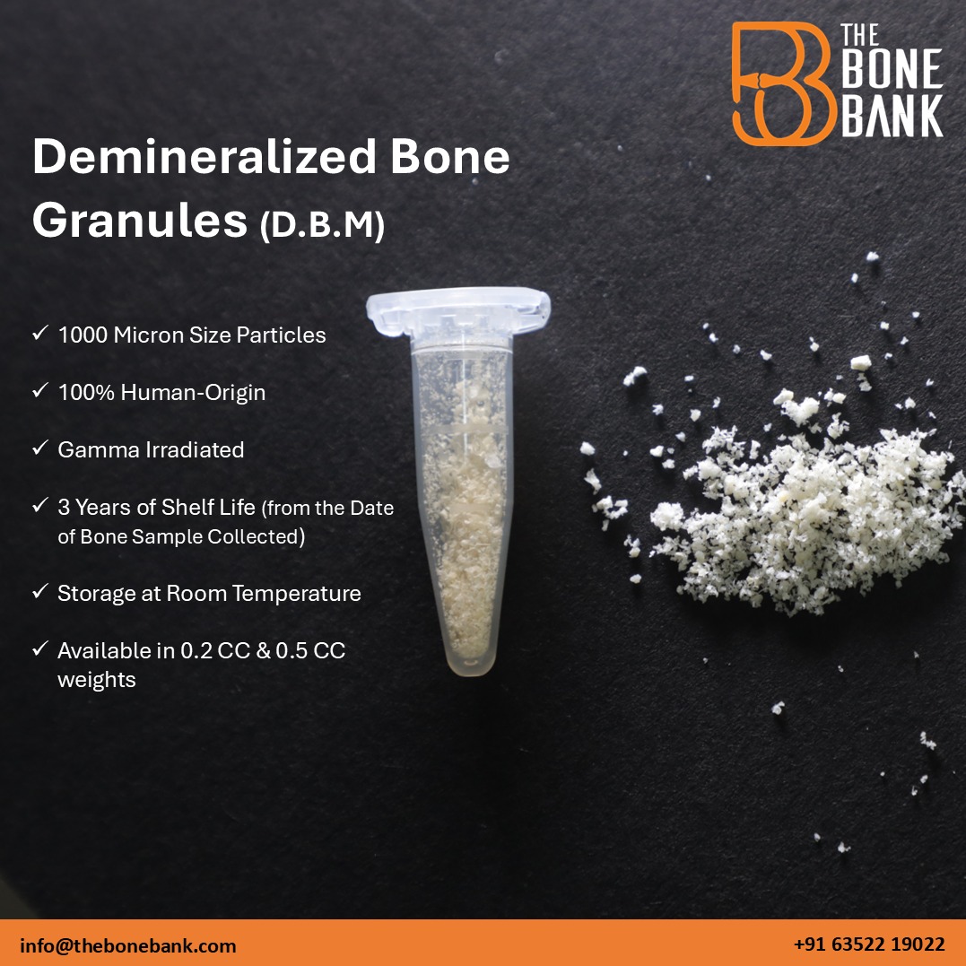 thebonebank's tweet photo. 🦴 Demineralized Bone Granules by The Bone Bank 🦴
A Perfect Substitute to Synthetic Graft
✔️ 1000 Micron Particle Size
✔️ 100% Human-Origin
✔️ Gamma Irradiated
✔️ 3-Year Shelf Life (from date of bone sample collection)
✔️ Room Temperature Storage
✔️ Available in: 0.2 CC &amp; 0.5 CC https://t.co/WuiFeLsZeq