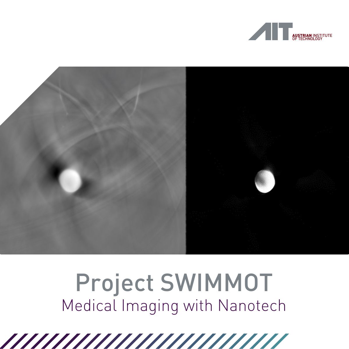 AIT researchers reduce background noise in medical imaging with nanotech, enhancing diabetes research. ait.ac.at/en/news-events…
#Horizon 2020 #MedicalImaging #Nanotechnology #DiabetesResearch #SWIMMOT #HealthandBioresources #MolecularDiagnostics