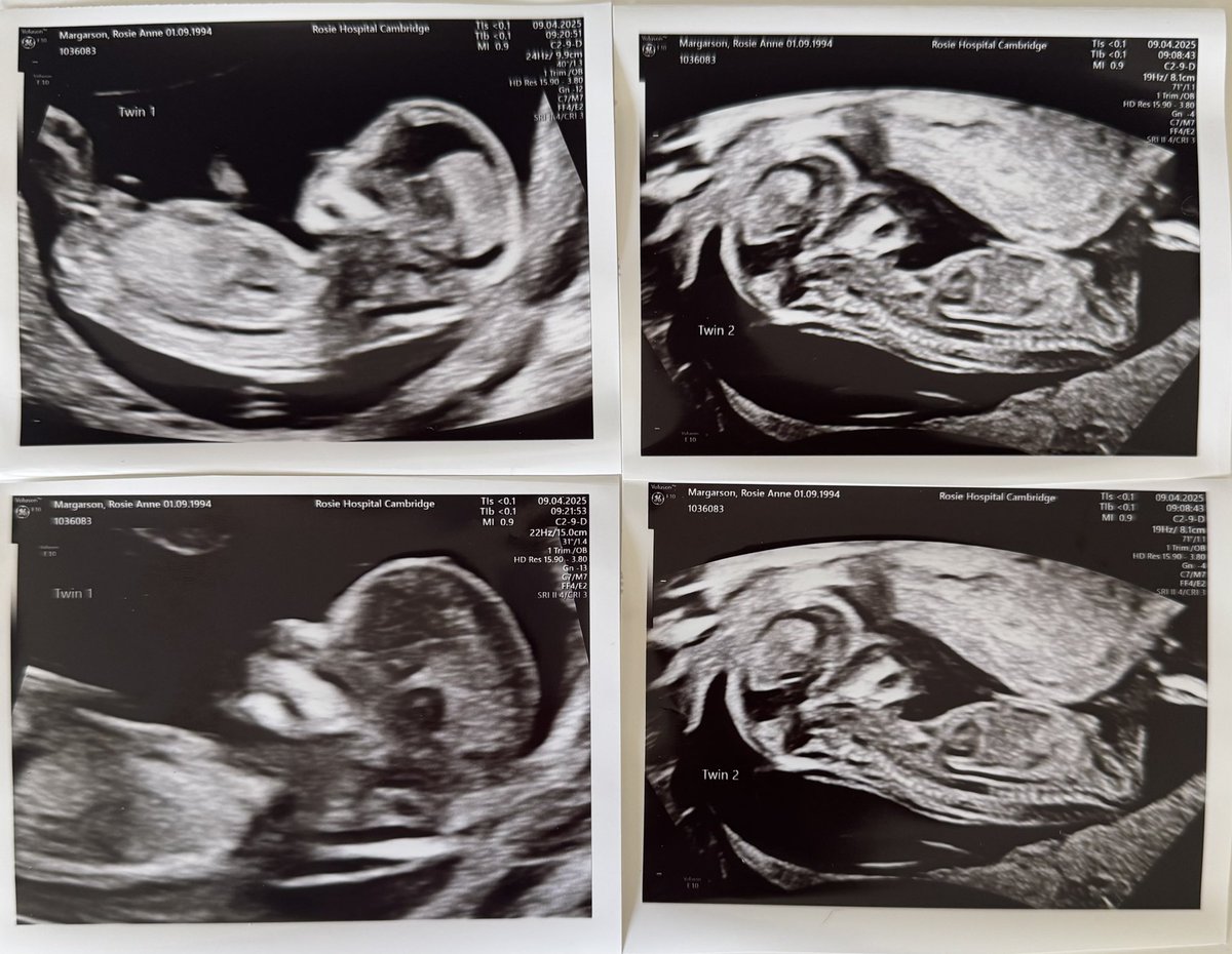 Rosie Margarson tweet media