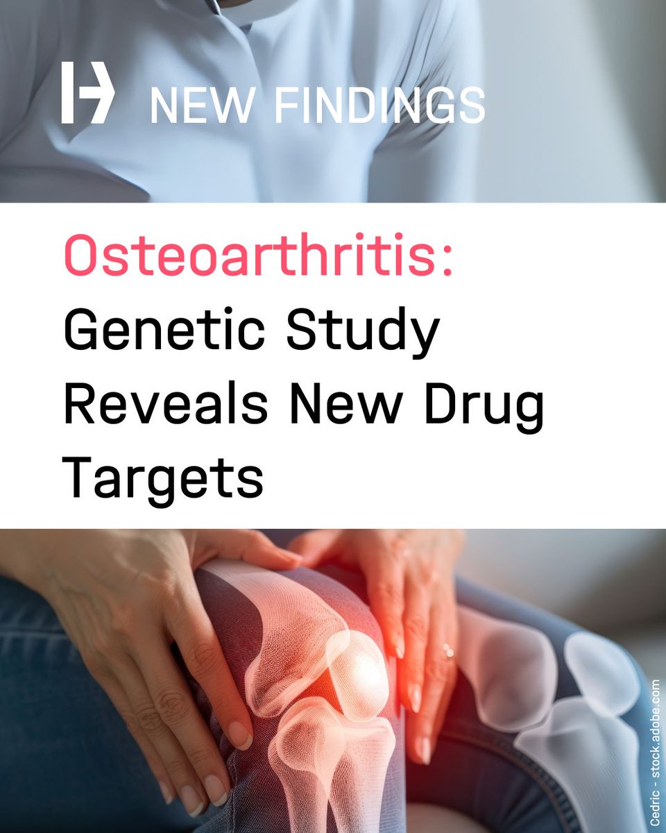 Osteoarthritis – Largest Genetic Study Reveals New Drug Targets 🧬
👉 t1p.de/acynm

An international team led by Prof. Eleftheria Zeggini, #HelmholtzMunich, has conducted the largest-ever genome-wide association study (GWAS) on osteoarthritis, analyzing data from