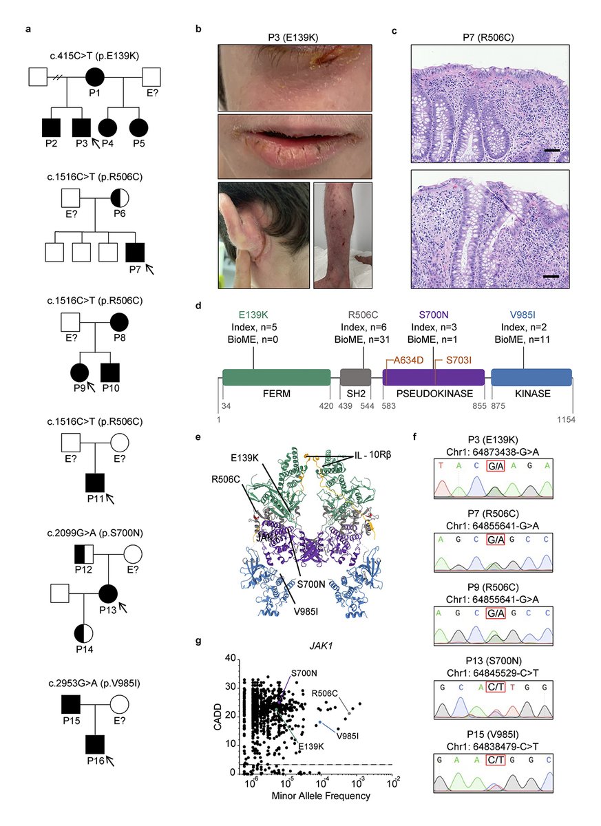 Horesh et al. @bogunoviclab show that individuals with JAK1 variants are affected by syndromic features encompassing #autoimmunity, #atopy, #colitis, and #dermatitis. hubs.la/Q03gh9Lr0

📘In Genes &amp; Immunity collection: hubs.la/Q03ggVlN0
#HKS2025