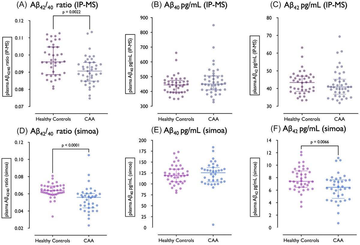 Alzheimer's & Dementia Journals (@alzdemjournals) on Twitter photo Plasma biomarkers enhance Cerebral Amyloid Angiopathy detection!🩸
Research from Alzheimer’s & Dementia demonstrate lower Aβ42/40 and elevated p-tau-181 effectively differentiate CAA from controls, opening doors for non-invasive diagnostics. #AlzResearch
alz-journals.onlinelibrary.wiley.com/doi/full/10.10… Plasma biomarkers enhance Cerebral Amyloid Angiopathy detection!🩸
Research from Alzheimer’s & Dementia demonstrate lower Aβ42/40 and elevated p-tau-181 effectively differentiate CAA from controls, opening doors for non-invasive diagnostics. #AlzResearch
alz-journals.onlinelibrary.wiley.com/doi/full/10.10…