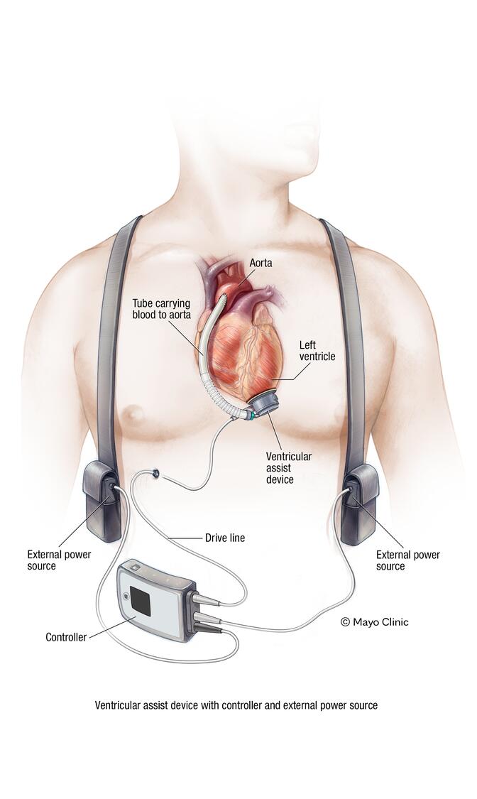 Mayo Clinic Cardiac Surgery tweet media
