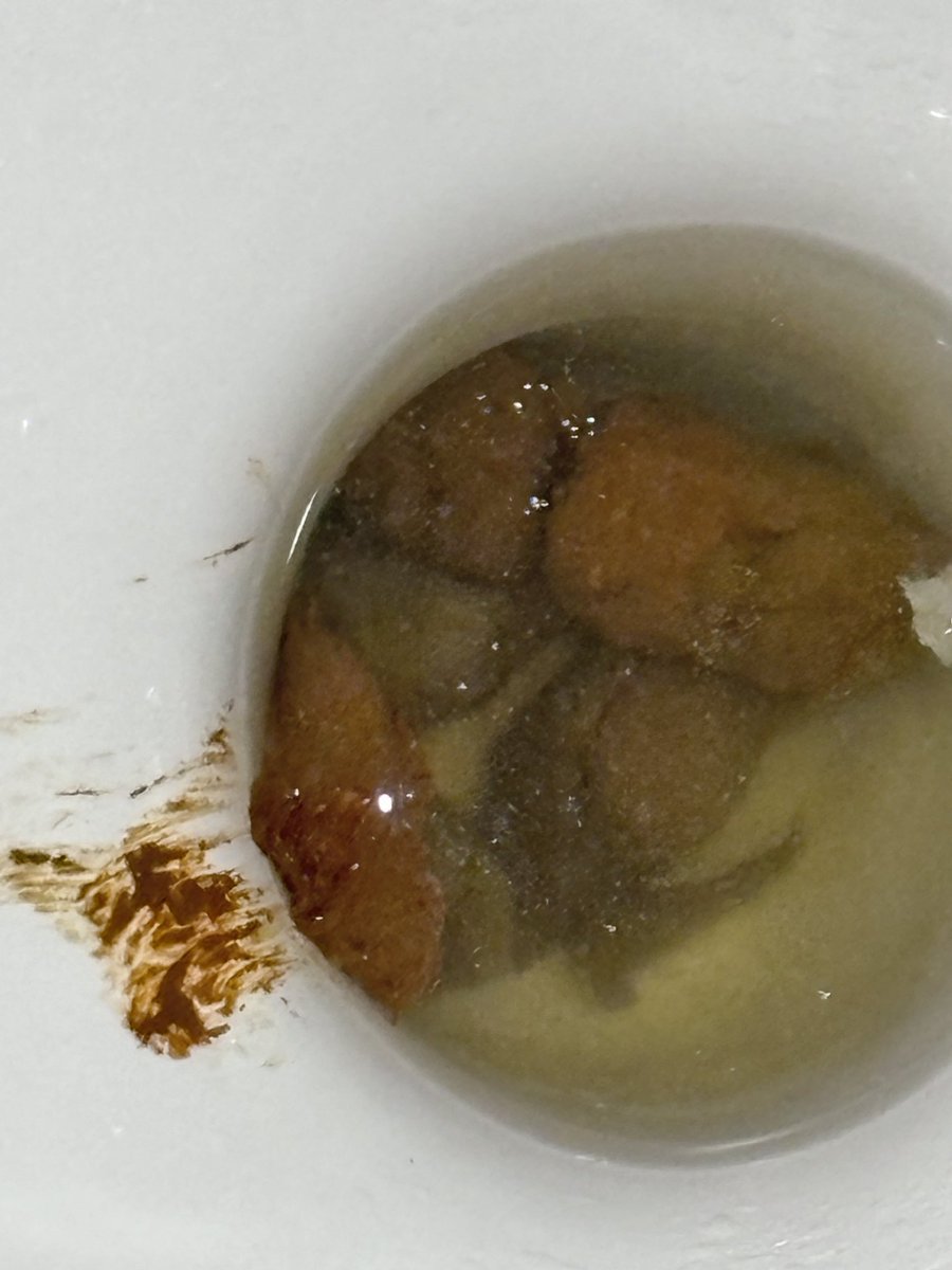 妈妈的奖励

#原味 #抽奖