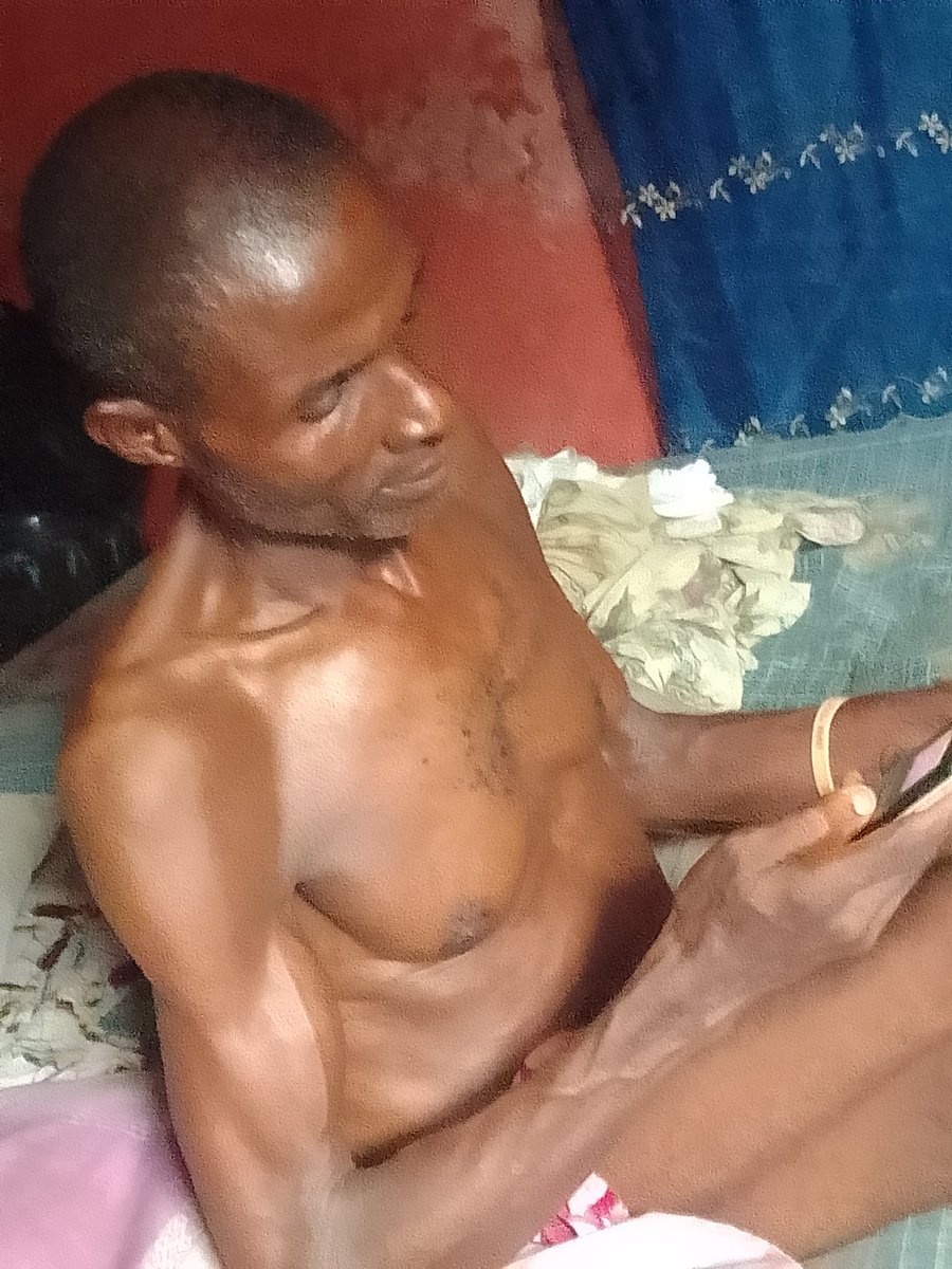 om_steve74788's tweet photo. "Please, I need your help. This is my father. He's suffering from a serious health condition,an enlarged gland that’s left him in this state. We urgently need support for his treatment. Any donation, share, or prayer would mean everything to us.Please help us save him. #HelpMyDad https://t.co/RyLR7cv1JE