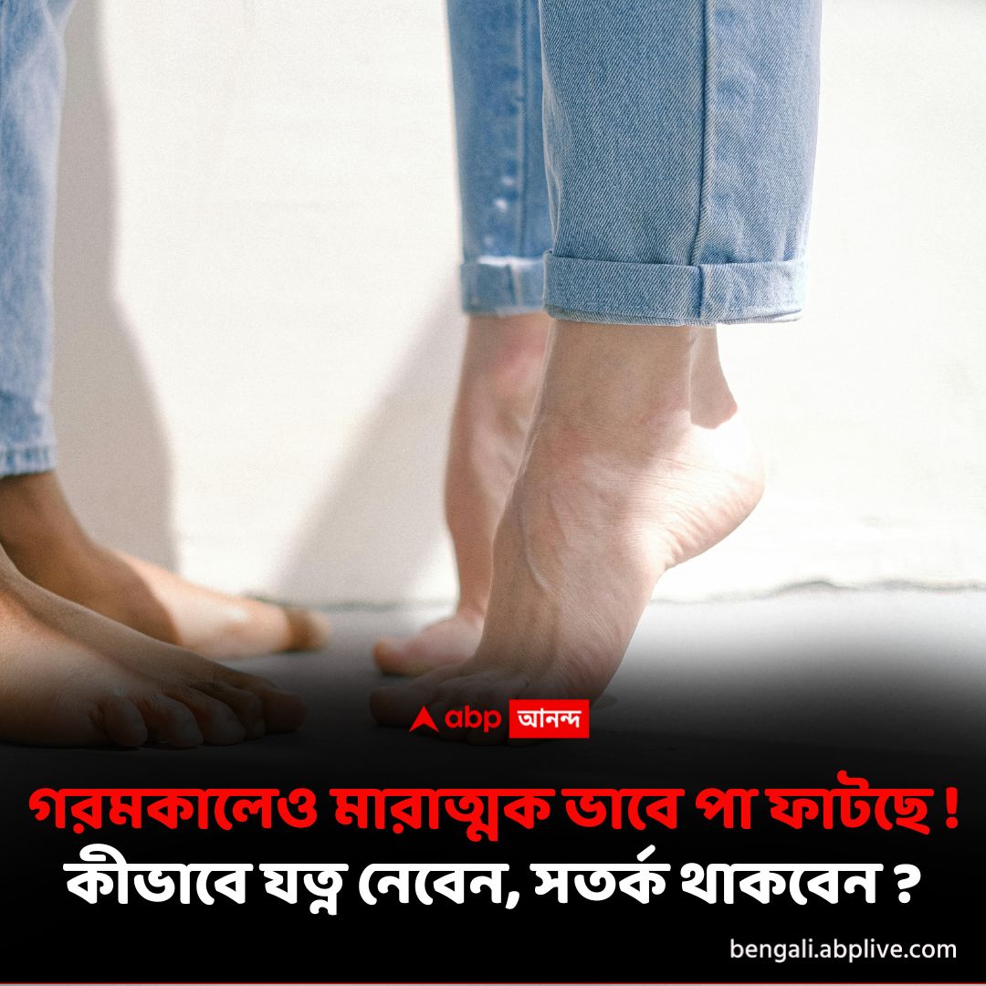 abpanandatv's tweet photo. গরমের মরশুমে পা-ফাটার সমস্যায় নাজেহাল? কীভাবে দূর করবেন ত্বকের এই অসুবিধা? বিস্তারিত পড়ুন- https://t.co/xZOfN72ITH

#crackedheels #SummerSkinCare #SummerSkincareRoutine #summerskincaretips https://t.co/y8dcCanSHo