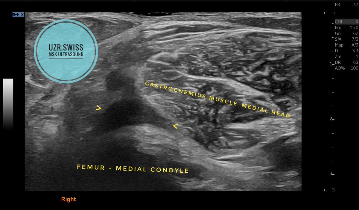 Sᴡɪss Uʟᴛʀᴀsᴏᴜɴᴅ Cᴇɴᴛᴇʀ - UZR tweet media