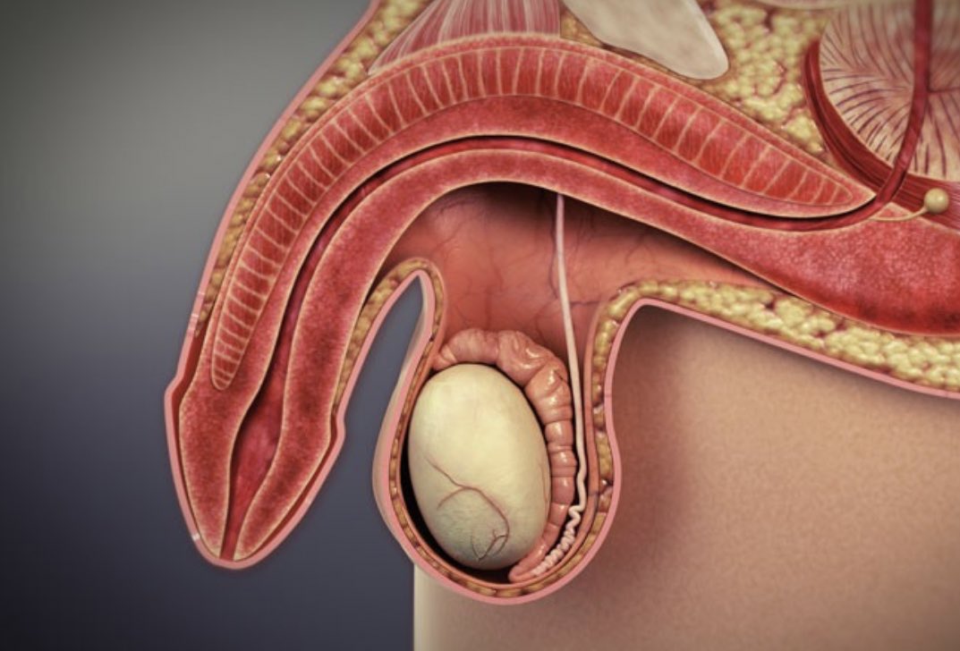 THE LINK BETWEEN DIABETES AND ERECTILE DYSFUNCTION

Research shows that over 50% of men with diabetes will experience ED, and it may occur 10-15 years earlier than in men without diabetes.

How does diabetes contribute to ED?

Everything you need to know👇🏼