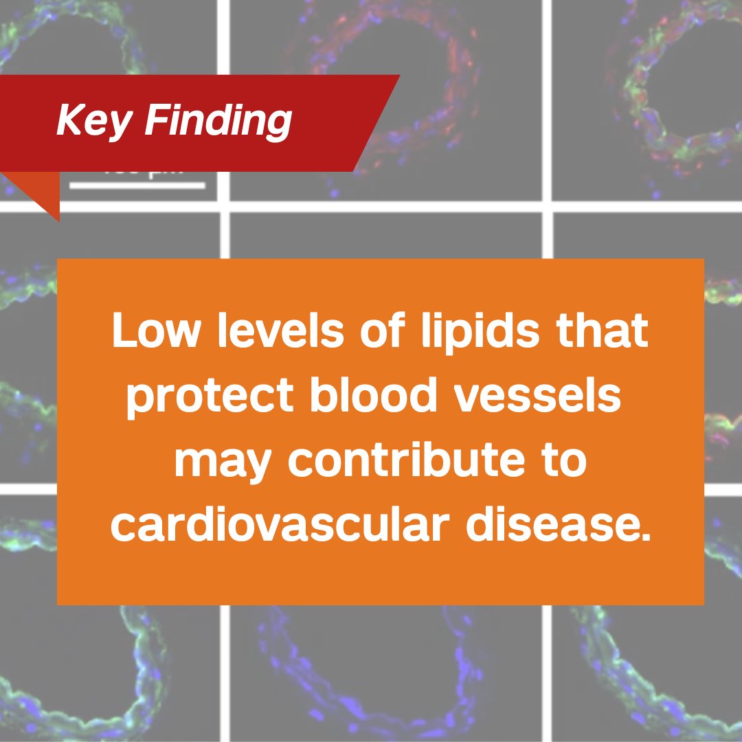 Weill Cornell Medicine (@weillcornell) on Twitter photo A new preclinical study finds that low levels of a type of fat called ceramides in blood vessels may drive the development of diabetes and obesity, according to research led by <a href="/WCMCPathology/">Weill Cornell Medicine Pathology</a>'s Dr. Annarita Di Lorenzo and colleagues.
Full story: bit.ly/3FXcMgz A new preclinical study finds that low levels of a type of fat called ceramides in blood vessels may drive the development of diabetes and obesity, according to research led by <a href="/WCMCPathology/">Weill Cornell Medicine Pathology</a>'s Dr. Annarita Di Lorenzo and colleagues.
Full story: bit.ly/3FXcMgz