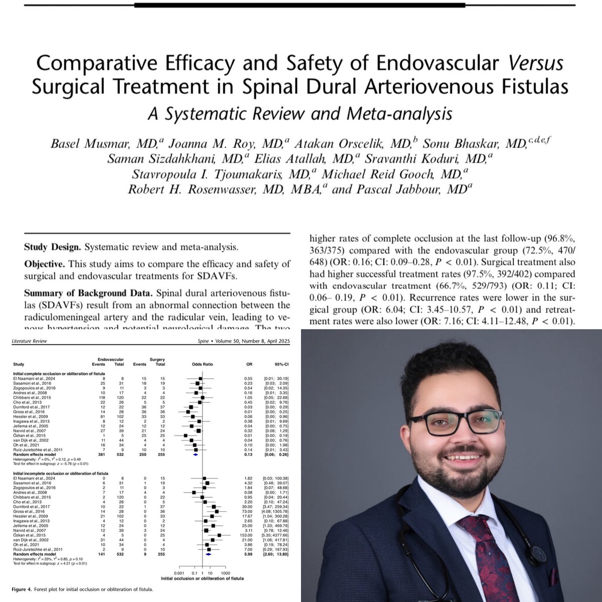 Pascal Jabbour MD, FAANS, FACS, FAHA (@pascaljabbourmd) on Twitter photo Open surgery versus Endovascular treatment of Type I spinal dural arteriovenous fistulas put together by <a href="/MusmarBasel/">Basel Musmar</a> our rockstar research fellow <a href="/TJUHNeurosurg/">Jefferson Neurosurgery</a> :
1- Open surgery is associated with higher rates of complete occlusion, lower recurrence, retreatment and initial Open surgery versus Endovascular treatment of Type I spinal dural arteriovenous fistulas put together by <a href="/MusmarBasel/">Basel Musmar</a> our rockstar research fellow <a href="/TJUHNeurosurg/">Jefferson Neurosurgery</a> :
1- Open surgery is associated with higher rates of complete occlusion, lower recurrence, retreatment and initial