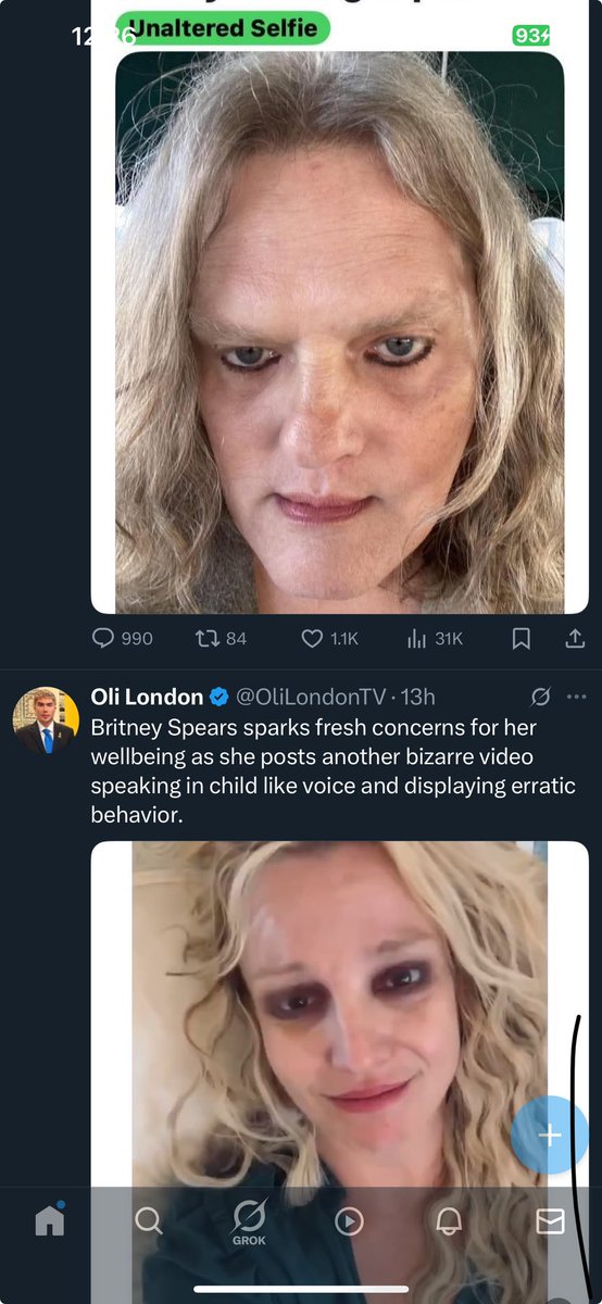 lol