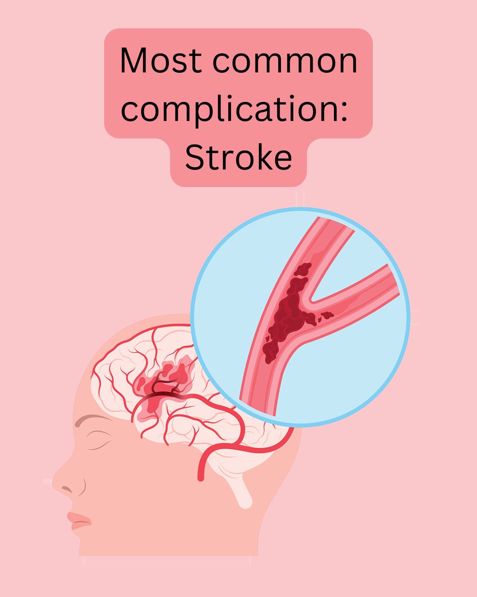 ECGsmart tweet media