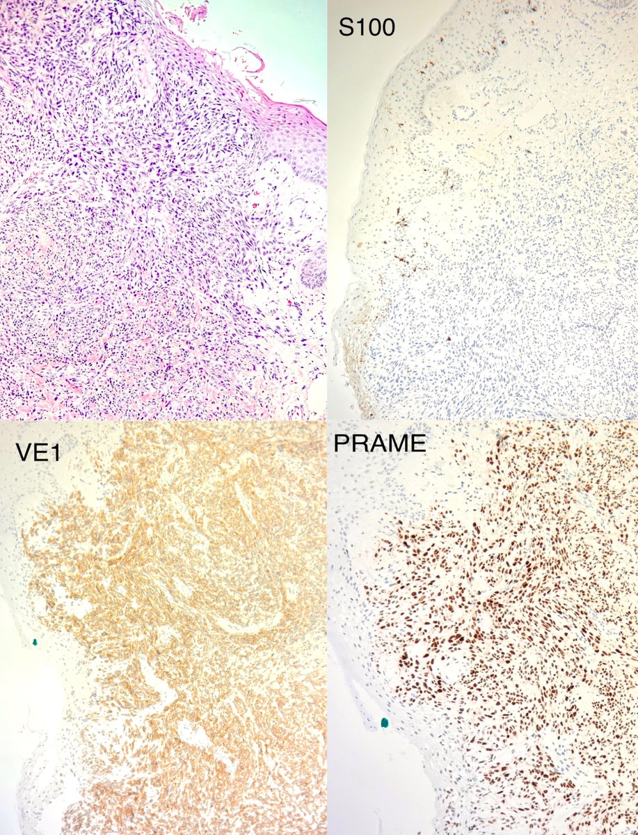 Francesco Fortarezza tweet media