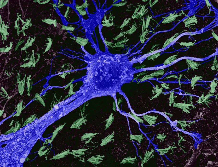 Science Magazine (@sciencemagazine) on Twitter photo A new optical biosensor can probe the activities of native GPCRs in live cells, and, unlike typical sensors doesn’t interfere with downstream signaling and can be deployed in many cell types with only a single construct. scim.ag/4cno5L1 <a href="/scisignal/">Science Signaling</a> A new optical biosensor can probe the activities of native GPCRs in live cells, and, unlike typical sensors doesn’t interfere with downstream signaling and can be deployed in many cell types with only a single construct. scim.ag/4cno5L1 <a href="/scisignal/">Science Signaling</a>