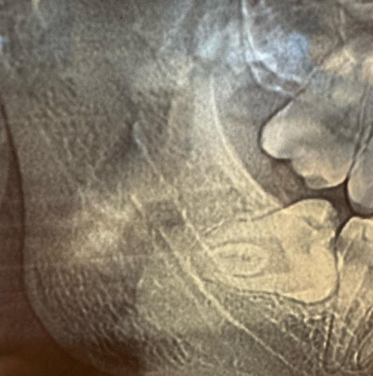 Meu siso tá deitado em berço esplêndido