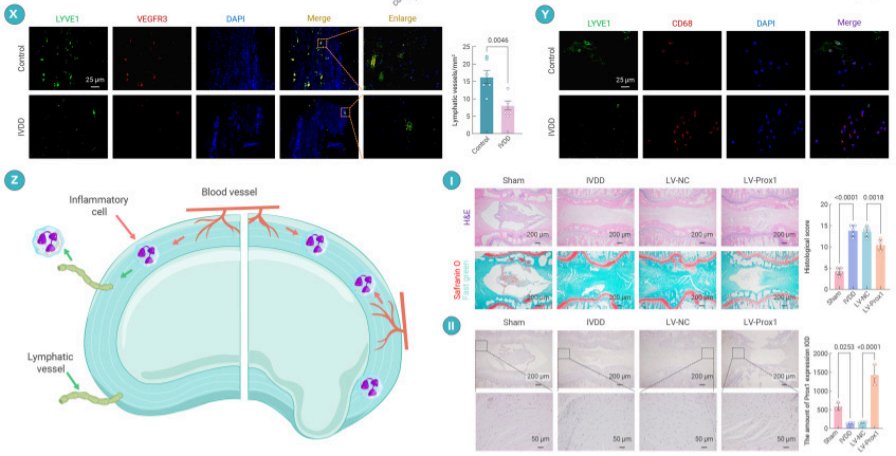 DavidMackeyDPT's tweet image. New research challenges belief that healthy intervertebral discs do not have lymphatic supply and suggests it may allow them to alleviate inflammation within the discs. This may open up new possibilities for future treatments of degenerative disc disease.
sciencedirect.com/science/articl…