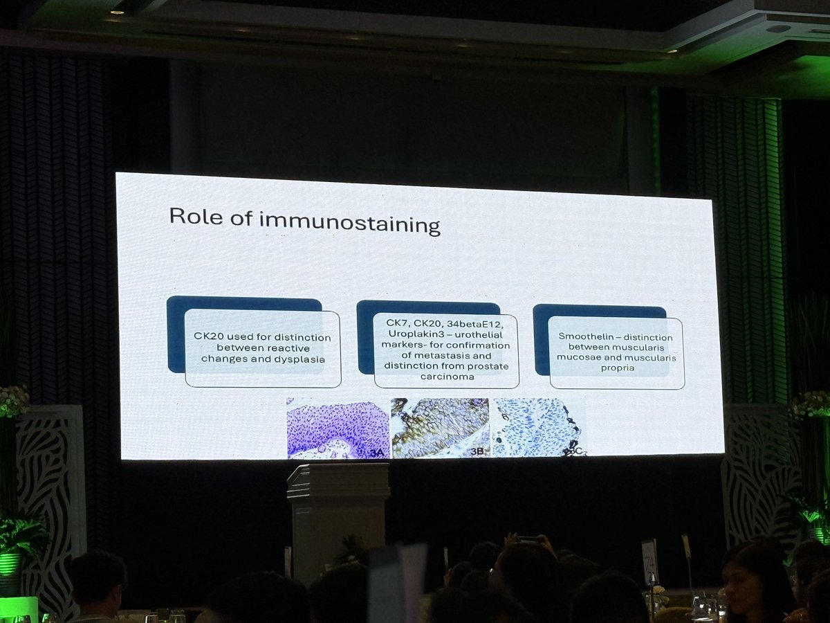Role of IHC staining for bladder biopsies

Thank you Dr. Chandra

#urothelialpathology #PSPAC2025