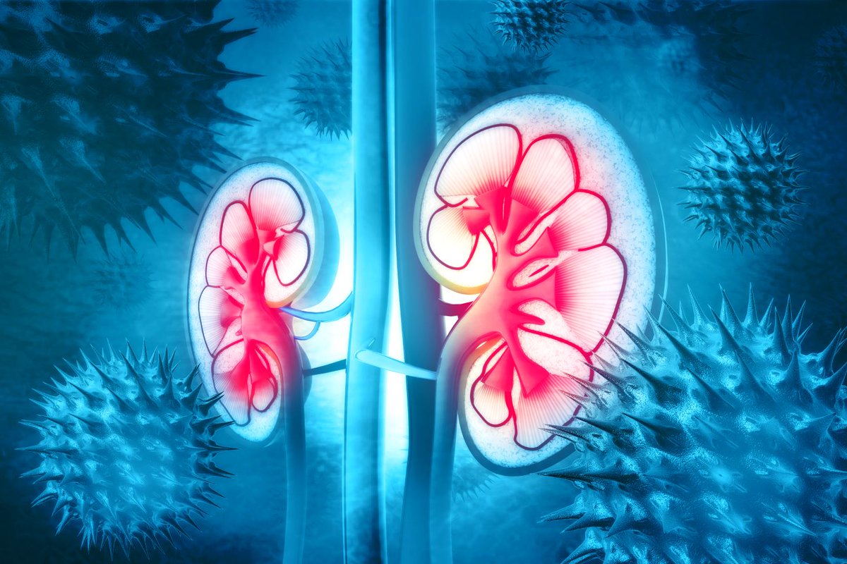 The IMJ (@the_imj) on Twitter photo IMJ April 2025 #FreeAccess
Original Article: Severe sepsis-associated acute kidney injury
bit.ly/42n35PM
<a href="/marrow/">Jeff Szer</a> <a href="/TheRACP/">The Royal Australasian College of Physicians</a> <a href="/WileyHealth/">Wiley Clinical Health</a> IMJ April 2025 #FreeAccess
Original Article: Severe sepsis-associated acute kidney injury
bit.ly/42n35PM
<a href="/marrow/">Jeff Szer</a> <a href="/TheRACP/">The Royal Australasian College of Physicians</a> <a href="/WileyHealth/">Wiley Clinical Health</a>