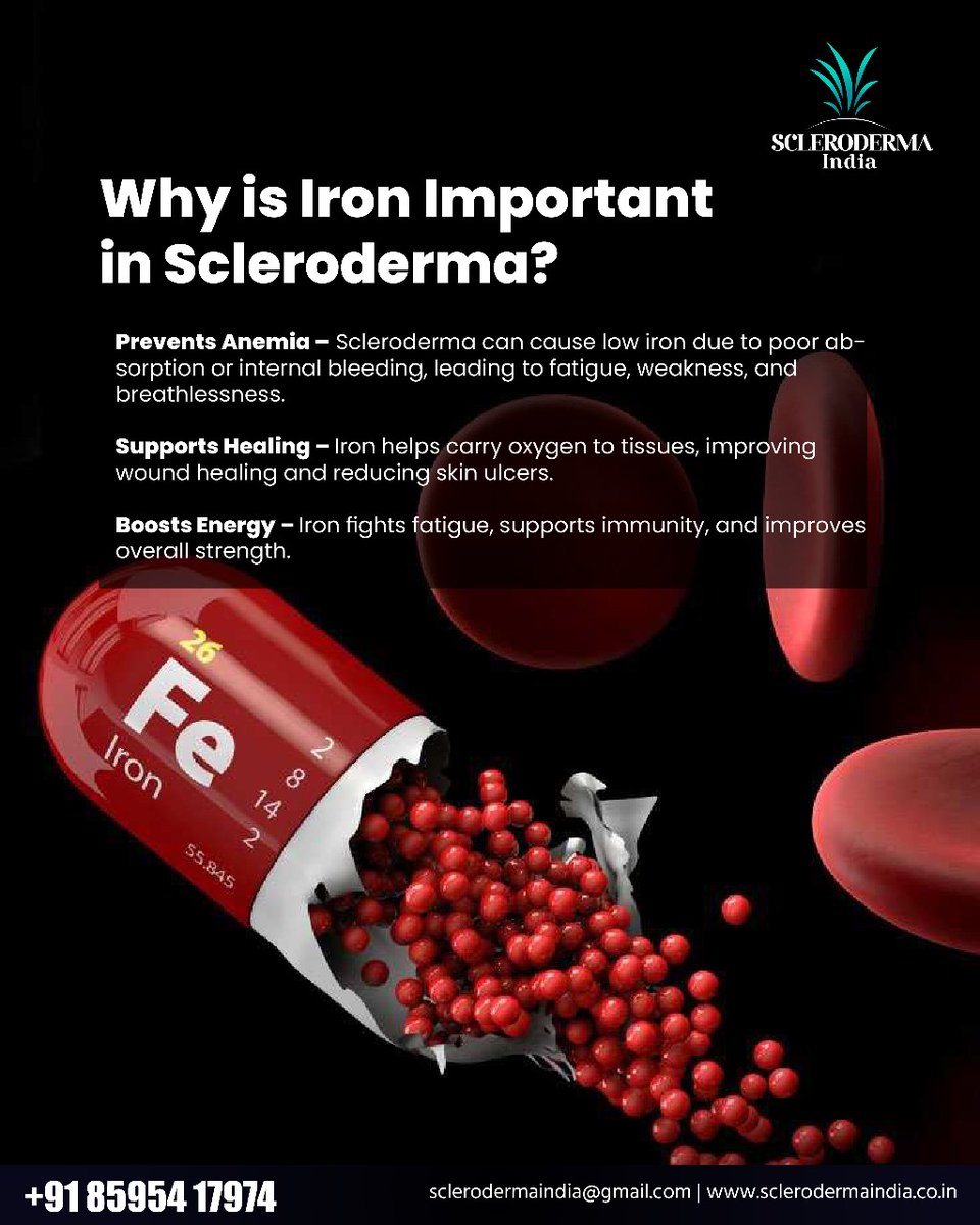 ScleroIndia's tweet image. Why is Iron Important in Scleroderma?
#SclerodermaIndia #Scleroderma #ChronicIllness #AutoImmuneDisease #Nutrients #Nutrition #Iron #Minerals #Malnutrition