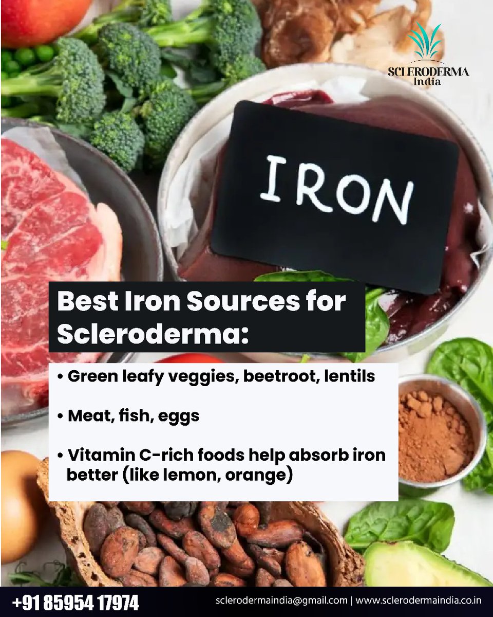ScleroIndia's tweet image. Why is Iron Important in Scleroderma?
#SclerodermaIndia #Scleroderma #ChronicIllness #AutoImmuneDisease #Nutrients #Nutrition #Iron #Minerals #Malnutrition