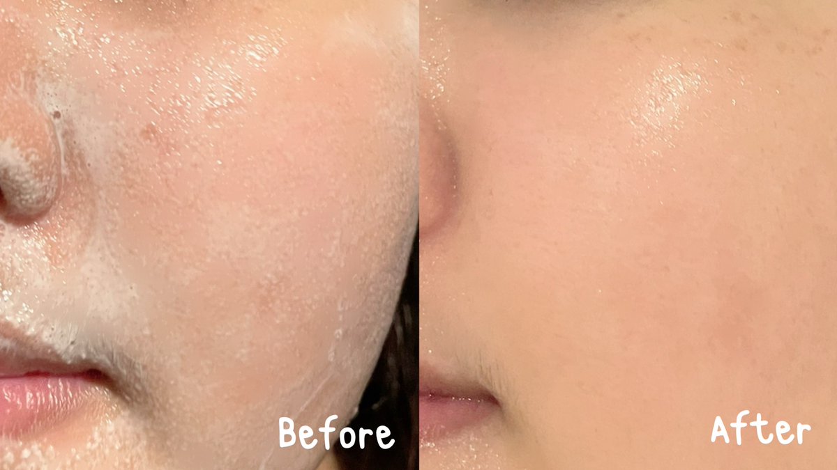 ช่วงนี้สิวบุกมาก เลยกลับมาใช้โฟมล้างหน้าของ Mentholatum Acnes🧴🫧
Clear & Whitening Wash สิวที่ขึ้นใหม่ลดลงไม่ก่อให้เกิดสิวเพิ่ม แถมลดรอยสิว ช่วยให้หน้าดูกระจ่างใสขึ้นด้วย vit c  เอาง่ายๆอยากผิวดีหน้าใสไม่มีสิวต้องใช้เลยตัวนี้ เป็นเวชสำอางธรรมชาติ อ่อนโยนสุดๆ✨🤏🏻 
#โฟมลดสิวเซเว่น  #โฟมล้างหน้าลดสิว #เมนโทลาทั่มแอคเน่ส์