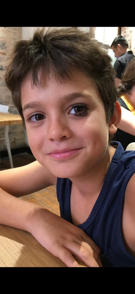 #AhmetMinguzziEmsalOlsun
Mühür gözlü çocuk kalbimiz seninle😞