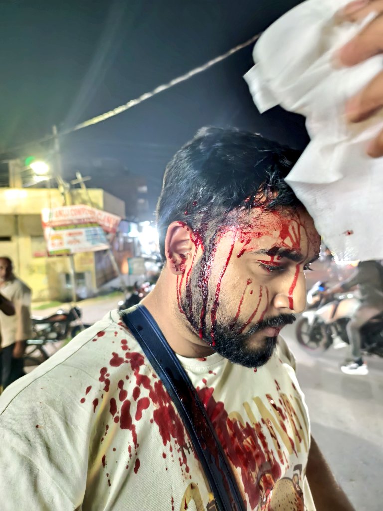 RajneeshCh26348's tweet photo. @UPGovt @Uppolice @lkopolice @brajeshpathakup @CMOfficeUP @SSaadatganj @narendramodi @aajtak @ZeeNews @ABPNews @BBCHindi @CNNnews18 @ProDefLko
आप सभी से मेरी विनती है कि इस पर जल्द से जल्द उचित कार्रवाई की जाए थाना ठाकुरगंज इसमें कोई भी तेजी नहीं दिख रहा है आज 5 दिन बीत चुके है। https://t.co/rEkJfrvEJD