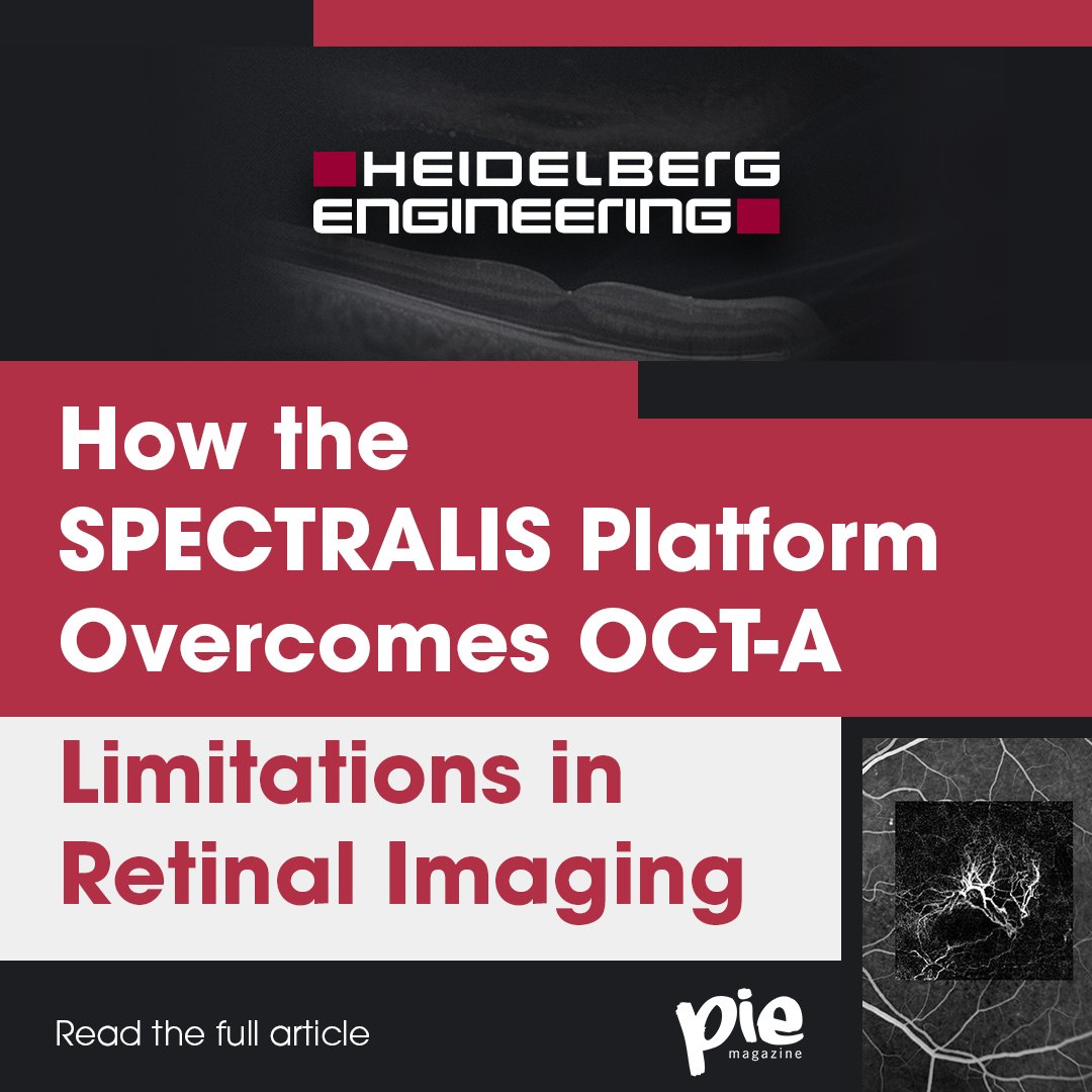 "<a href="/HeidelbergEngUK/">Heidelberg Engineering Ltd.</a>’s SPECTRALIS ensures diagnostic confidence and clinical certainty in retinal vasculature imaging," says Christopher Mody. Read more piemagazine.org/visualizing-th… to see how it tackles OCT-A challenges, from motion artifacts to vascular complexities.