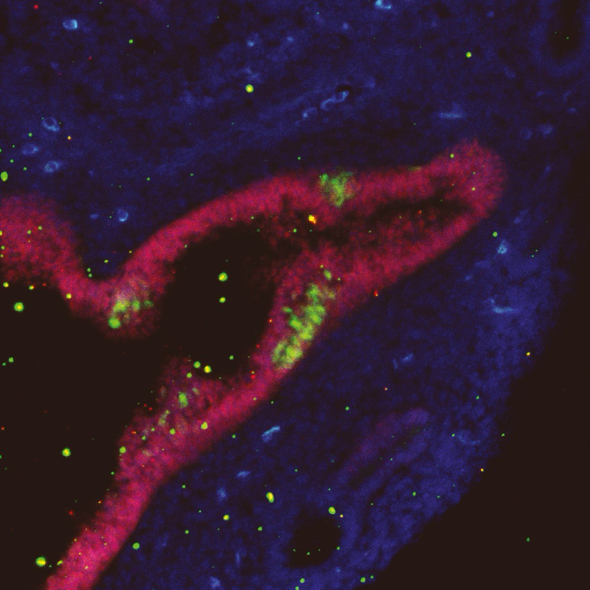 MPI Molecular Biomedicine (@mpi_muenster) on Twitter photo Detection of neural stem cells outside the brain: international study in mice could be a breakthrough for regenerative medicine. International study published in <a href="/NatureCellBio/">Nature Cell Biology</a> by Dong Han, Hans R. Schöler and many others.
🔗📢Press release: mpi-muenster.mpg.de/press-release/… Detection of neural stem cells outside the brain: international study in mice could be a breakthrough for regenerative medicine. International study published in <a href="/NatureCellBio/">Nature Cell Biology</a> by Dong Han, Hans R. Schöler and many others.
🔗📢Press release: mpi-muenster.mpg.de/press-release/…