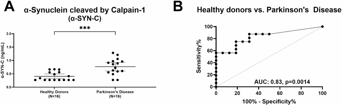 The Science of Parkinson's (@scienceofpd) on Twitter photo New research from <a href="/SigneHNPhD/">Signe Holm Nielsen</a> & <a href="/Nordic_Bio/">Nordic Bioscience</a> colleagues finds a fragment of Calpain-1 cleaved α-Synuclein (α-Syn-C biomarker) quantified in serum is up-regulated in 2 study cohorts of people with #Parkinsons (discovery N=16/16 evaluation PD/C & 30/15)
nature.com/articles/s4159… New research from <a href="/SigneHNPhD/">Signe Holm Nielsen</a> & <a href="/Nordic_Bio/">Nordic Bioscience</a> colleagues finds a fragment of Calpain-1 cleaved α-Synuclein (α-Syn-C biomarker) quantified in serum is up-regulated in 2 study cohorts of people with #Parkinsons (discovery N=16/16 evaluation PD/C & 30/15)
nature.com/articles/s4159…