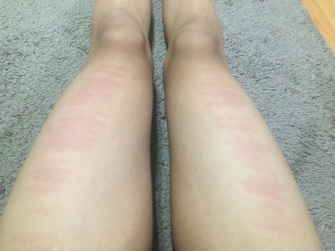 예전이네요
근데 허벅지 스마타가 뭔가요?
오늘만 두 분이 해달라고 문의 주셨는데 둘 다 어디론가 없어졌어요

#종아리체벌 #허벅지체벌 #발바닥체벌 #엉덩이체벌 #멜키 #멜섭 #스팽킹 #멜커 #펨커 #멜돔 #펨돔