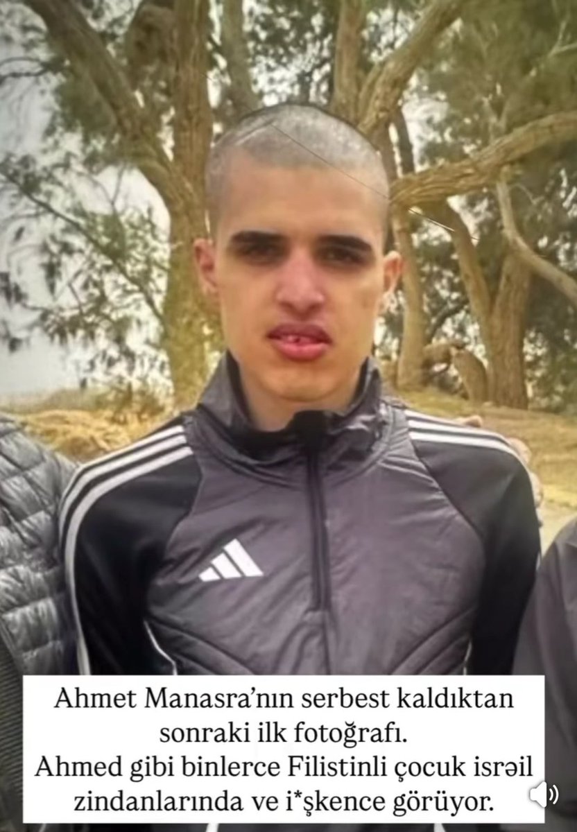 13 yaşında esir alınan ,hiç çocuk olmadan hepimizin yüreğinde büyüyen
Ahmedimiz 10 senenin sonunda serbest bırakıldı ...

13 yaşında girdiği hapisten 23 23 yaşında ayrılıyor .
Dile kolay ..
#ahmetmanasra