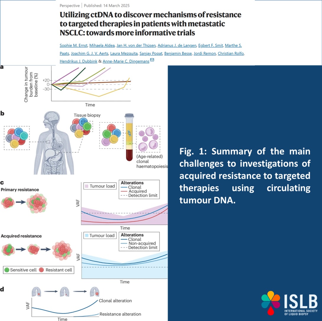 International Society of Liquid Biopsy (@isliquidbiopsy) on Twitter photo 🚨 New Perspective on ctDNA in NSCLC: Understanding Acquired Resistance 🧬🩸
📖 <a href="/NatRevClinOncol/">NatureRevClinOncol</a> , 2025
🔬 This expert review outlines how circulating tumor DNA (ctDNA) is reshaping the detection of acquired resistance to targeted therapies in metastatic NSCLC.
🔍 Key 🚨 New Perspective on ctDNA in NSCLC: Understanding Acquired Resistance 🧬🩸
📖 <a href="/NatRevClinOncol/">NatureRevClinOncol</a> , 2025
🔬 This expert review outlines how circulating tumor DNA (ctDNA) is reshaping the detection of acquired resistance to targeted therapies in metastatic NSCLC.
🔍 Key