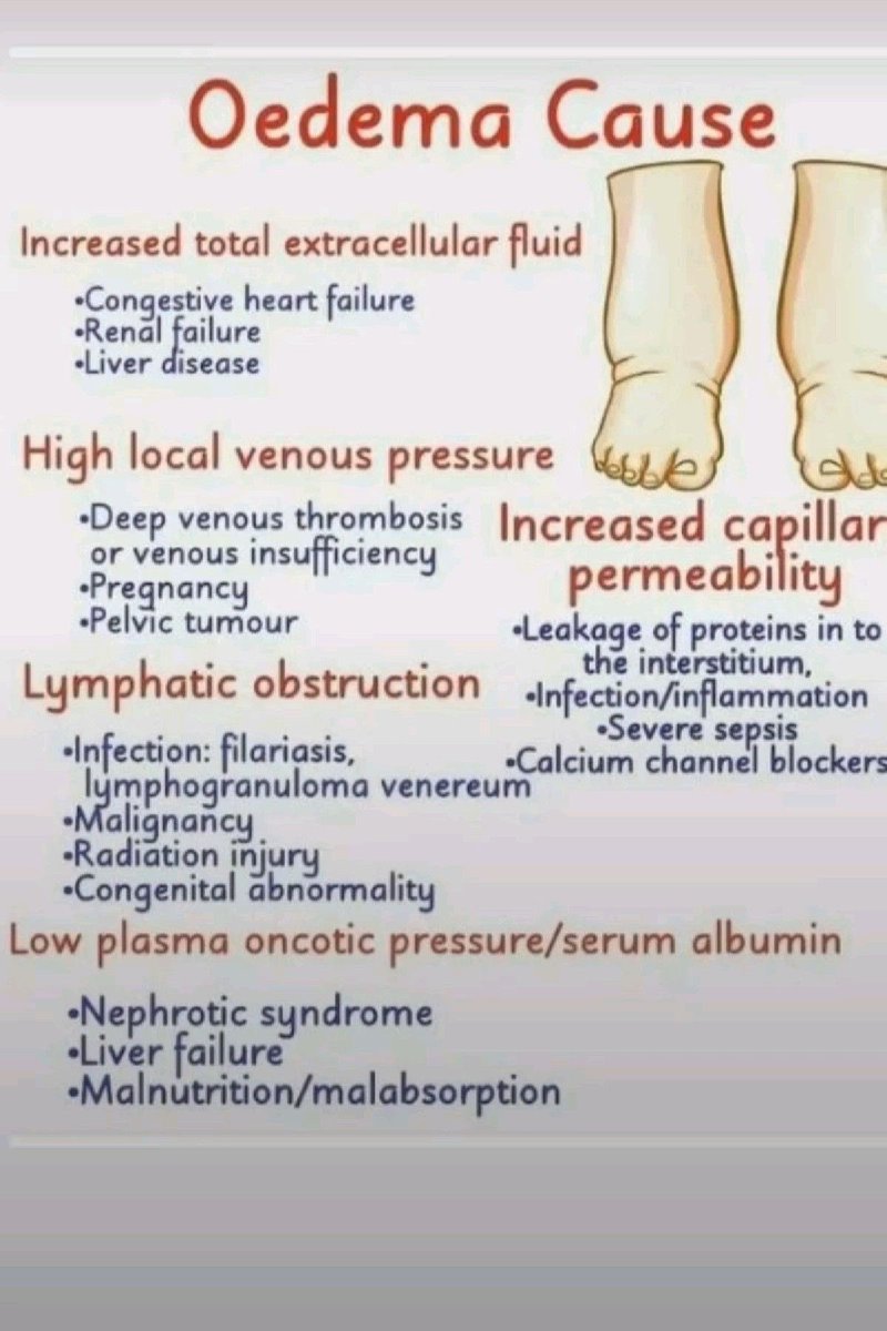 OGdukeneurosurg's tweet photo. Edema causes https://t.co/cTyRt7FXh2