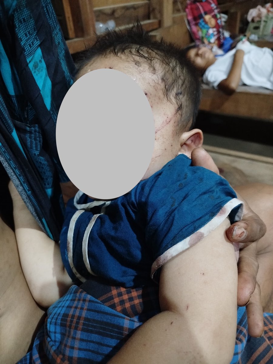 A young boy emerged as the sole survivor when an airstrike by the junta regime brutally claimed the lives of six family members in a matter of seconds last night in Myanmar. 

At such a tender age, and unable to even speak yet, he now faces a stark future in an orphanage,