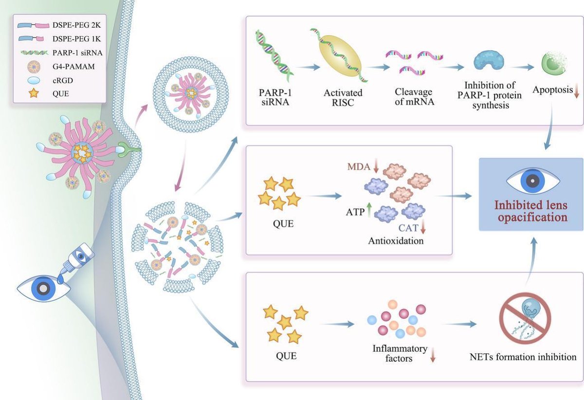JCRnEDITORS's tweet photo. Hybrid micellar preparations for co-delivery of PARP-1 siRNA and quercetin for cataract treatment.
| Xiang Li, Jiangxi Univ. of Chinese Medicine |
[50 days' free access]
#micelle #siRNA #codelivery #cataract
https://t.co/7lsF1tIf6C https://t.co/khOvPXVhT2