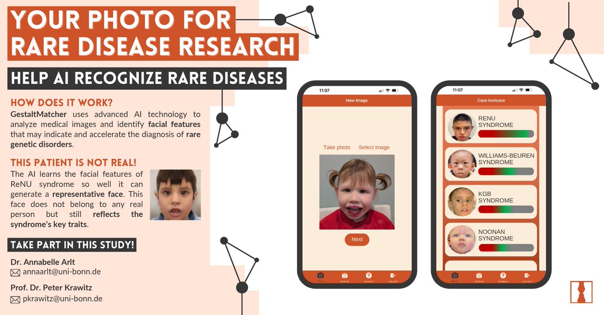 GestaltMatcher (.eth) (@gestaltmatcher) on Twitter photo We're excited to see <a href="/GestaltMatcher/">GestaltMatcher (.eth)</a> featured in the April newsletter of ReNU Syndrome United! A big thank you to the ReNu community for including us and for connecting families, researchers, and clinicians 🧡
🔗 Newsletter: renusyndrome.org/newsletter-apr… We're excited to see <a href="/GestaltMatcher/">GestaltMatcher (.eth)</a> featured in the April newsletter of ReNU Syndrome United! A big thank you to the ReNu community for including us and for connecting families, researchers, and clinicians 🧡
🔗 Newsletter: renusyndrome.org/newsletter-apr…