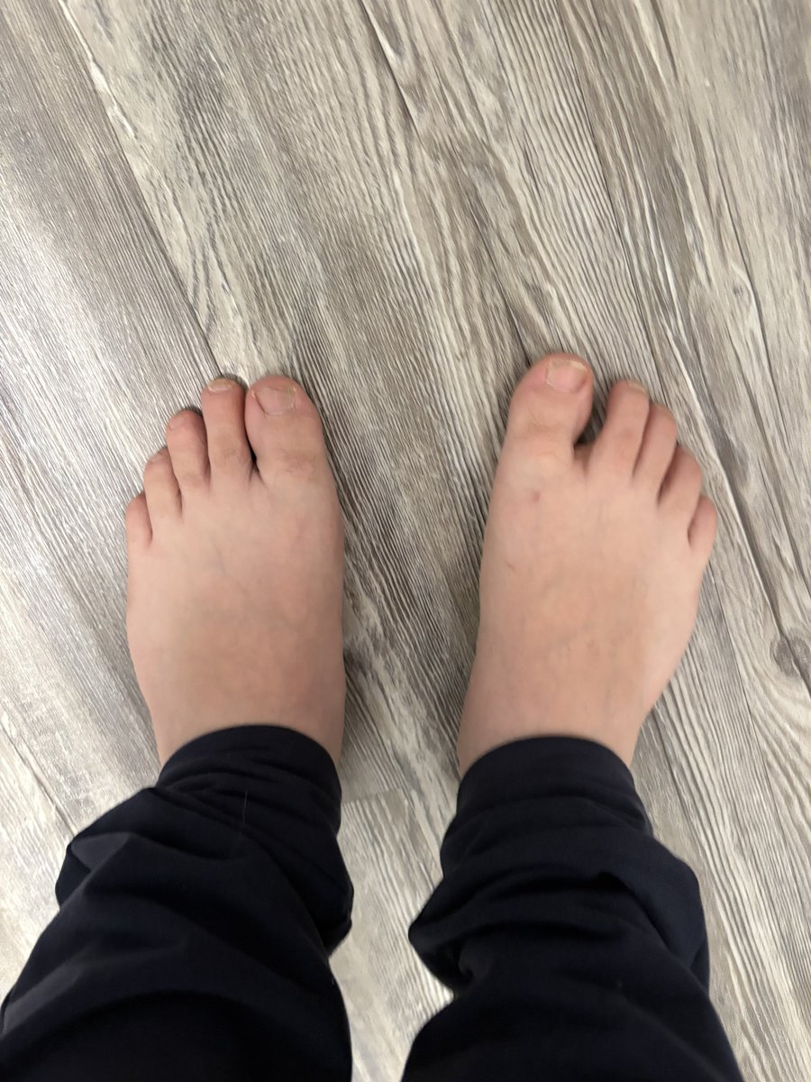What y’all think, my tops look good? Lmk who would love to suck these toes 😈😈

#GayBait #FootFetish
#gayfeet #malefeet #footfetish #gayfootfetish
#feet #maletoes #malesoles #footworship #gay #instagay #gaysoles #gaytoes #malefootfetish #feetlovers #footporn #feetporn
