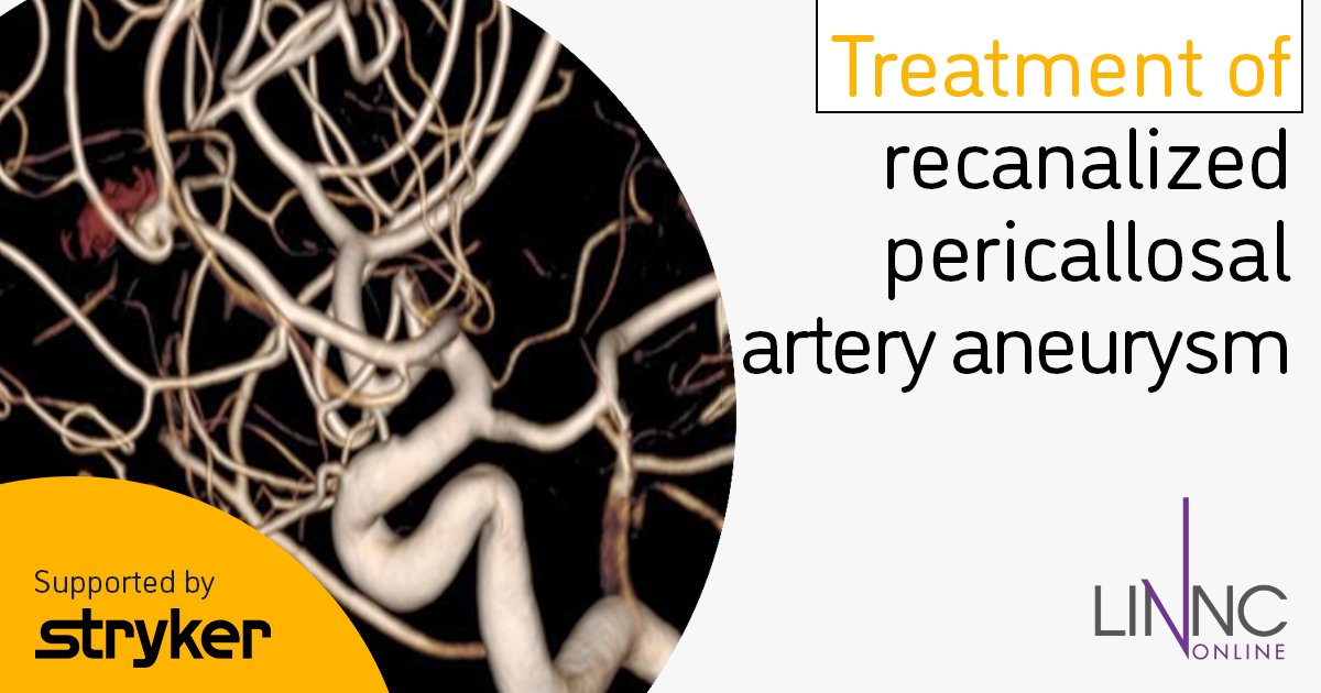LINNConline's tweet photo. ⚡ New case report: Recanalized #pericallosal artery #aneurysm
Discover how Dr. Jared Knopman from Weill Cornell Medical Center (New York) treated this aneurysm using Target Tetra Detachable Coils.
🖼️ Explore the imaging and read the full case report here: https://t.co/EXkaK2hHwy https://t.co/ftVwj7s5HG