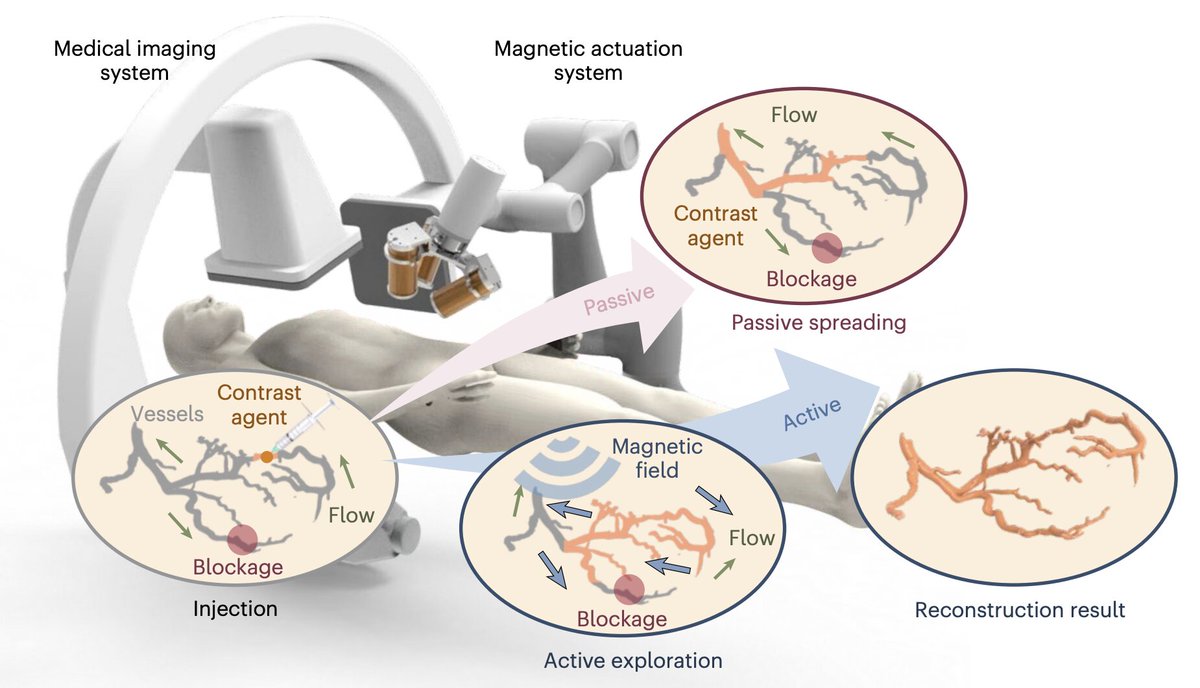 PatWorlddata's tweet photo. Magnetic microrobot swarm enables 3D imaging of vascular networks https://t.co/VU84yeIhkM 

#Microbot #Robotics #Medtech #Innovation #3dImaging #VasularHealth https://t.co/BaFpKqBUFV