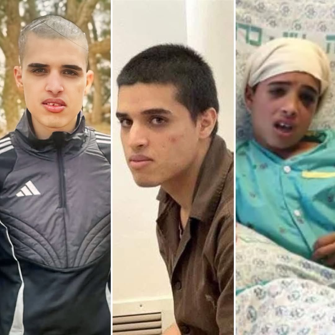 EyeonPalestine's tweet photo. Without chains or glass, prisoner Ahmad Manasra will return to his mother’s embrace today, after 10 years in prison—most in solitary confinement. Arrested as a wounded, innocent 12-year-old, he now walks free, a young man with chronic illnesses, after enduring brutal interrogations no man could bear.

بدون قيود أو زجاج، سيعود الأسير أحمد مناصرة إلى حضن والدته اليوم، بعد قضائه 10 سنوات في السجن، معظمها في العزل. تم اعتقاله وهو طفل بريء مصاب في عمر 12 عامًا، واليوم يخرج حراً، شاباً يعاني من أمراض مزمنة، بعد أن تعرض لتحقيقات قاسية لا يستطيع تحملها أي رجل.