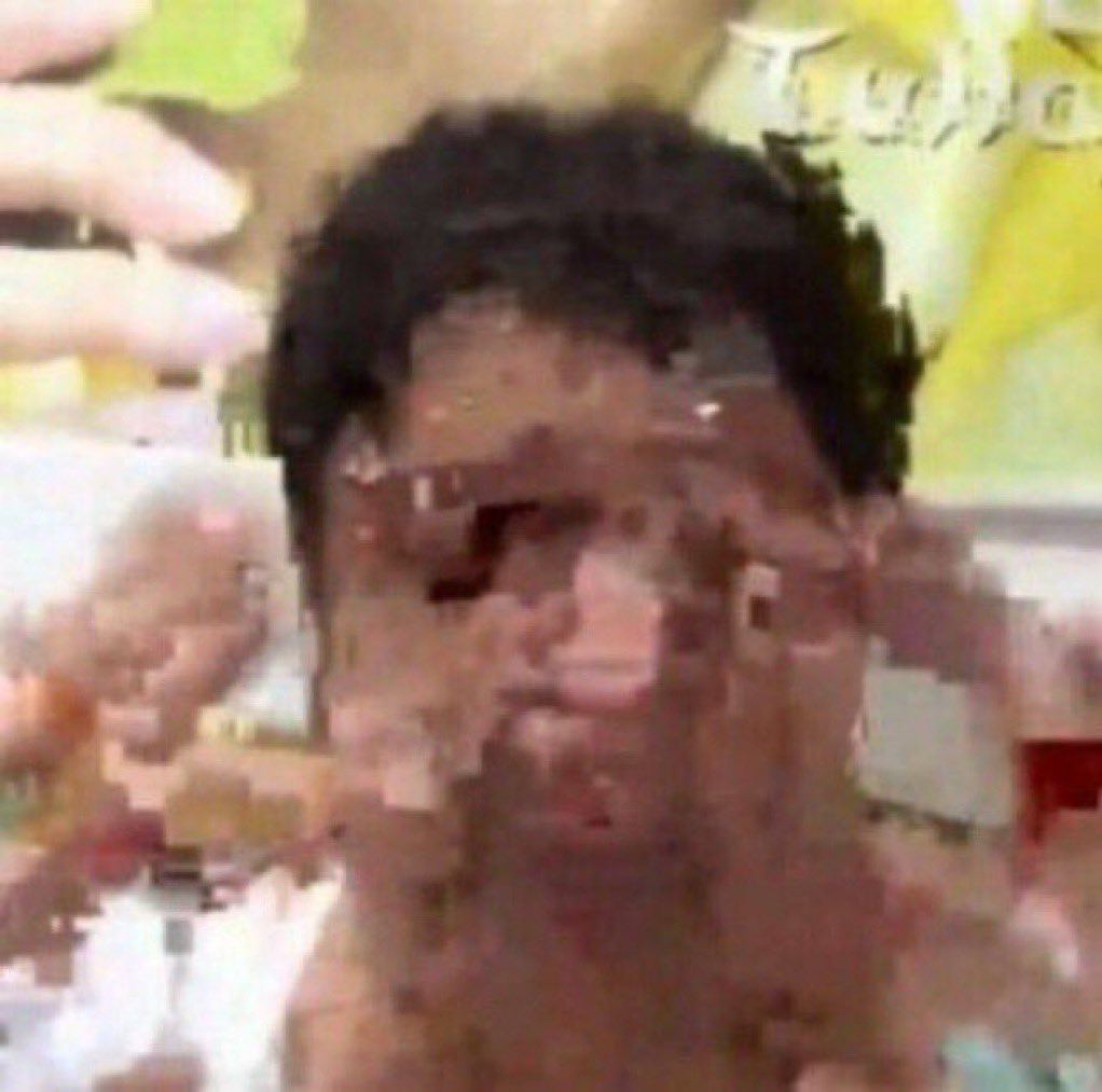 hoje de manhã eu coloquei minhas lentes de contato e fui trabalhar mas não estava enxergando nada, achei que estava ficando cego, bateu desespero, dps de um tempo percebi que eu tinha colocado as lentes do meu namorado (-3) ao invés das minhas (-5,5)