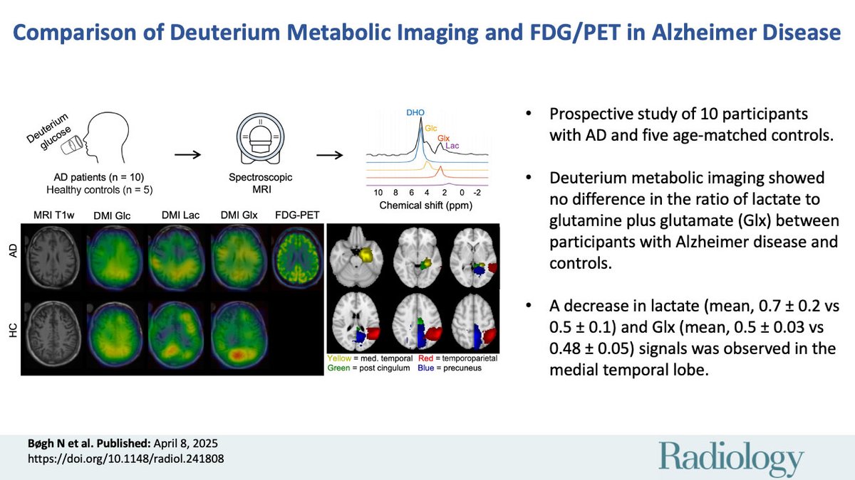 @RadiologyEditor (@radiologyeditor) on Twitter photo Can deuterium metabolic imaging offer insights into Alzheimer’s? 🧠 While it showed strong alignment with FDG PET in AD patients, it couldn’t distinguish AD from age-matched controls. See what <a href="/chris_laustsen/">Christoffer Laustsen</a> and team discovered! #Radiology #Alzheimers
pubs.rsna.org/doi/10.1148/ra… Can deuterium metabolic imaging offer insights into Alzheimer’s? 🧠 While it showed strong alignment with FDG PET in AD patients, it couldn’t distinguish AD from age-matched controls. See what <a href="/chris_laustsen/">Christoffer Laustsen</a> and team discovered! #Radiology #Alzheimers
pubs.rsna.org/doi/10.1148/ra…