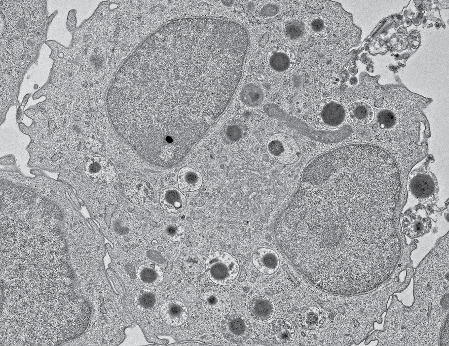Science Immunology (@sciimmunology) on Twitter photo A new Science #Immunology study in mice suggests that bacterial skin infections can imprint #eosinophils with #innate immune memory and enhance allergic inflammation in the lungs. @philippstarkl <a href="/MaryemRadhouani/">Mariem Radhouani</a> scim.ag/42oIdbc A new Science #Immunology study in mice suggests that bacterial skin infections can imprint #eosinophils with #innate immune memory and enhance allergic inflammation in the lungs. @philippstarkl <a href="/MaryemRadhouani/">Mariem Radhouani</a> scim.ag/42oIdbc