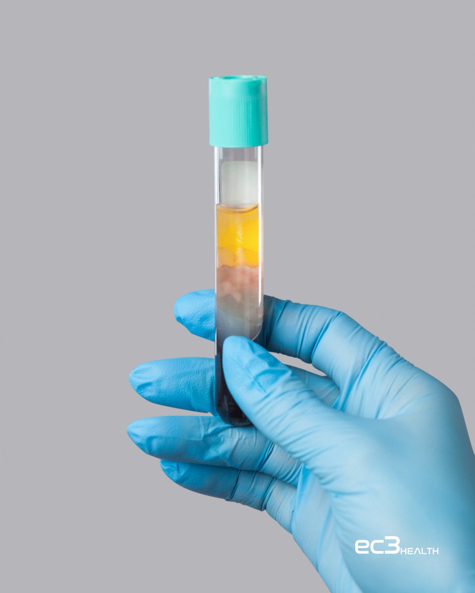 DavidCaddell3's tweet photo. 💉 Faster Healing with PRP Therapy!
 
PRP Therapy delivers natural healing by promoting tissue repair and regeneration. Ideal for aesthetics, orthopedics, and pain management. Give your patients the best recovery tool available.

#PRPTherapy #HealingNaturally #EC3Health https://t.co/1hGTs1M1Mb
